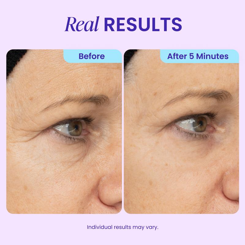 Biotech Collagen Targeting: Engineered with advanced clinical bio-actives to intensely support and rebuild the delicate under-eye supportive matrix.
