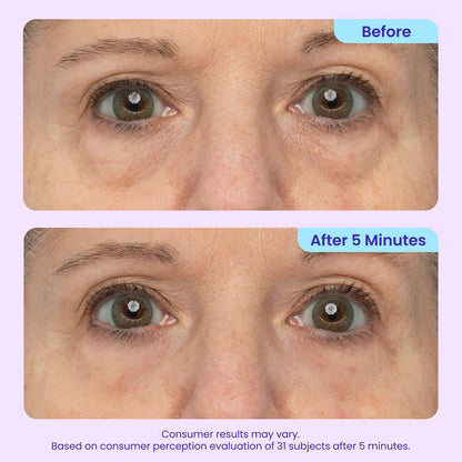 Biotech Collagen Targeting: Engineered with advanced clinical bio-actives to intensely support and rebuild the delicate under-eye supportive matrix.