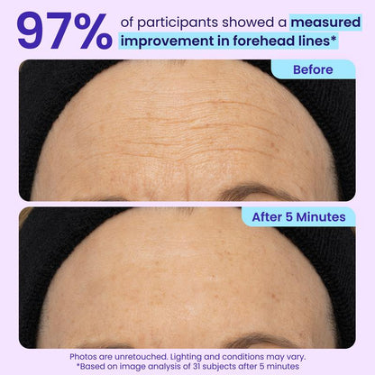 Biotech Collagen Targeting: Engineered with advanced clinical bio-actives to intensely support and rebuild the delicate under-eye supportive matrix.
