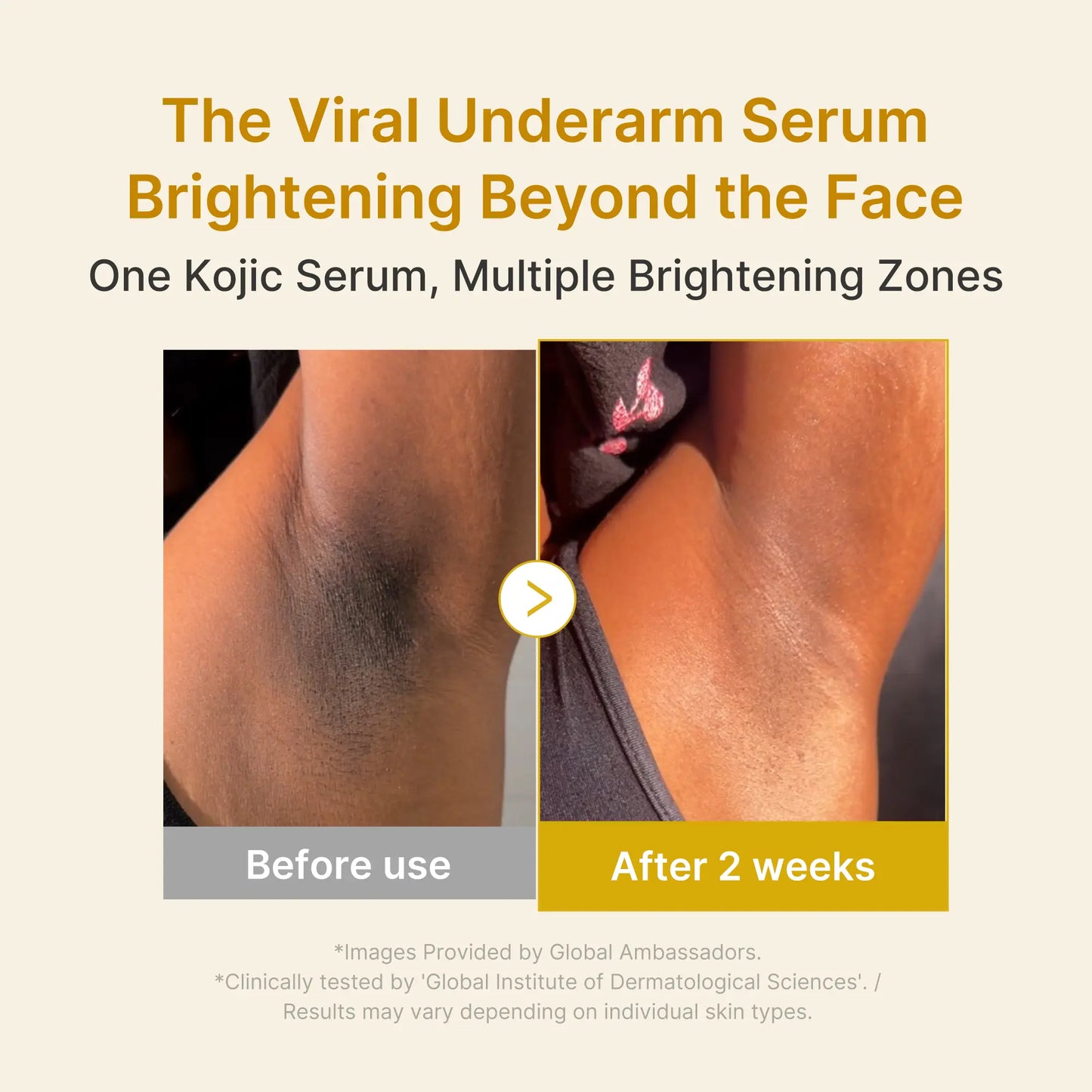 Kojic Acid & Turmeric Brightening Power Trio