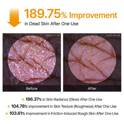 Kojic Acid &amp; Turmeric KP Bump Eraser Body Peeling Spray – Exfoliating Treatment for Smooth, Even Skin