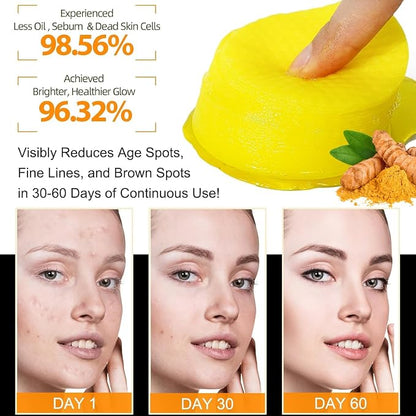 Turmeric & Kojic Acid Cleansing Pads 40 Pads – Deep Pore Clean, Oil Balance, Blemish Care, Hydrating Brightening Facial Pads